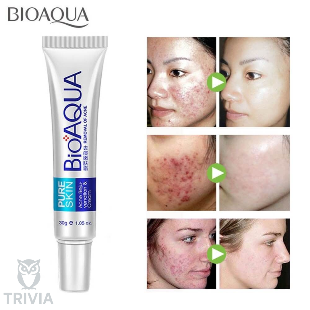 BIOAQUA™ Crema Antiacné